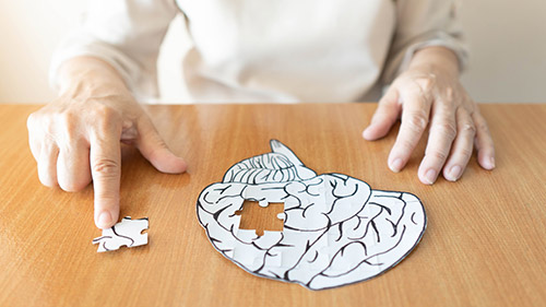 The Three Major Alzheimer’s Disease Stages with Brief Description - Hiram, GA